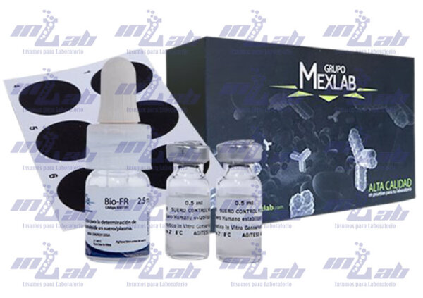 FACTOR REUMATOIDE